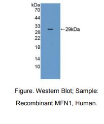 https://msimg.bioon.com/bionline/goods-no-pic.png