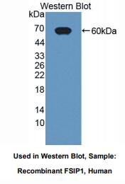 人纤维鞘相互作用蛋白1(FSIP1)多克隆抗体