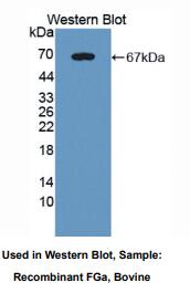 牛纤维蛋白原α(FGA)多克隆抗体