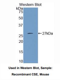 https://msimg.bioon.com/bionline/goods-no-pic.png