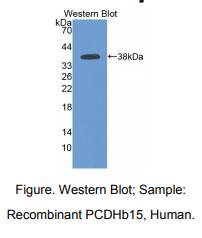 人原钙黏素β15(PCDHb15)多克隆抗体