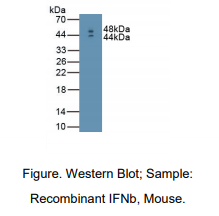 https://msimg.bioon.com/bionline/goods-no-pic.png