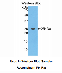 https://msimg.bioon.com/bionline/goods-no-pic.png