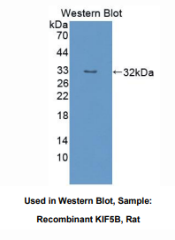 https://msimg.bioon.com/bionline/goods-no-pic.png