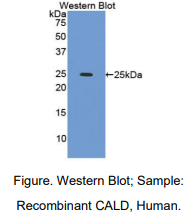 人钙调结合蛋白(CALD)多克隆抗体