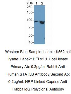 人信号传导转录激活因子5B(STAT5B)多克隆抗体