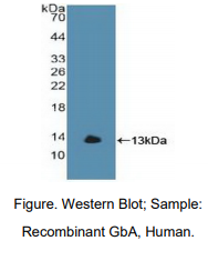 人葡萄糖脑苷脂酶(GBA)多克隆抗体
