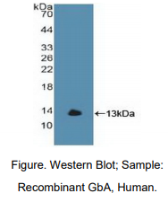 https://msimg.bioon.com/bionline/goods-no-pic.png