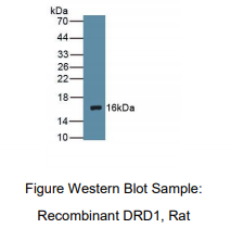 https://msimg.bioon.com/bionline/goods-no-pic.png