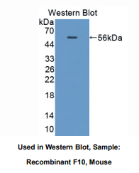 https://msimg.bioon.com/bionline/goods-no-pic.png