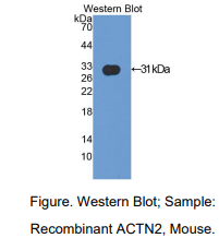 https://msimg.bioon.com/bionline/goods-no-pic.png