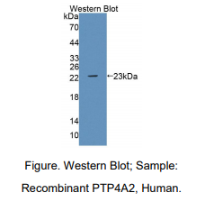 人蛋白酪氨酸磷酸酶ⅣA2(PTP4A2)多克隆抗体