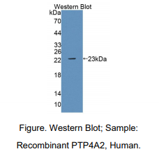 https://msimg.bioon.com/bionline/goods-no-pic.png