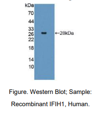 https://msimg.bioon.com/bionline/goods-no-pic.png