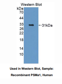 https://msimg.bioon.com/bionline/goods-no-pic.png