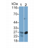 https://msimg.bioon.com/bionline/goods-no-pic.png