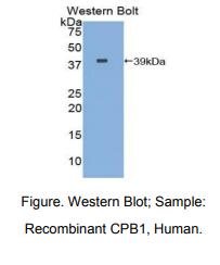 人羧肽酶B1(CPB1)多克隆抗体