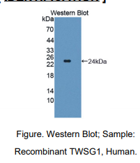 https://msimg.bioon.com/bionline/goods-no-pic.png