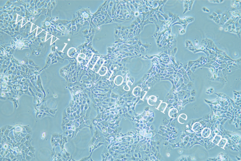 CAL-33细胞/CAL33细胞/CAL-33/CAL33/人舌磷癌细胞