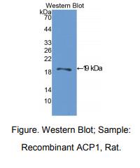 大鼠酸性磷酸酶1(ACP1)多克隆抗体