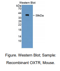 小鼠催产素受体(OXTR)多克隆抗体