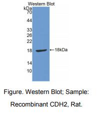 https://msimg.bioon.com/bionline/goods-no-pic.png