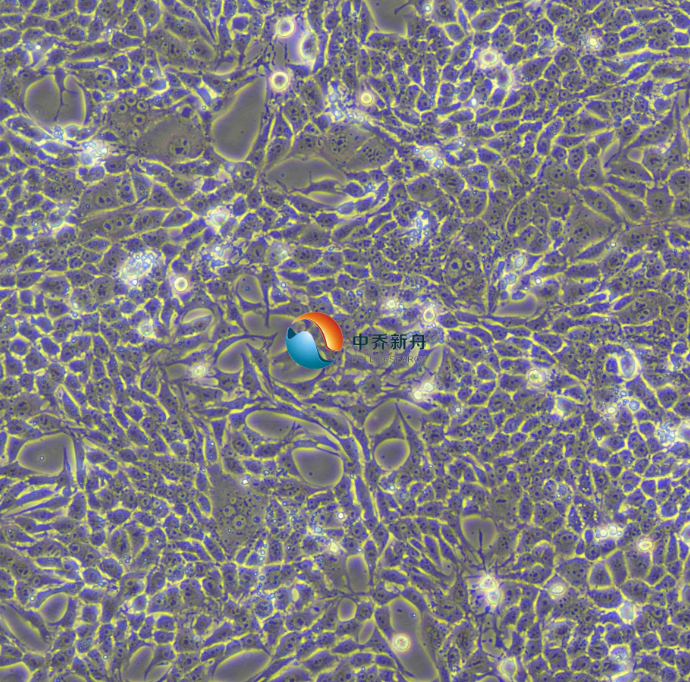https://img.medsci.cn/8eee53bbc4cb7a98de615e72115896bc4e27fda5cbb764dbd67d9d641c2bb46a.png