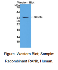 人核因子κB受体激活因子(RANk)多克隆抗体