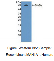 人甘露糖苷酶α1A类成员1(MAN1A1)多克隆抗体