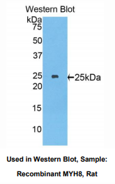 大鼠肌球蛋白重链8(MYH8)多克隆抗体
