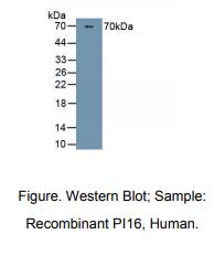 https://msimg.bioon.com/bionline/goods-no-pic.png