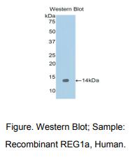 人再生胰岛衍生蛋白1α(REG1a)多克隆抗体