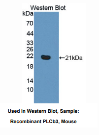 小鼠磷脂酰肌醇特异性磷酯酶Cβ3(PLCb3)多克隆抗体