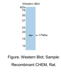 https://msimg.bioon.com/bionline/goods-no-pic.png