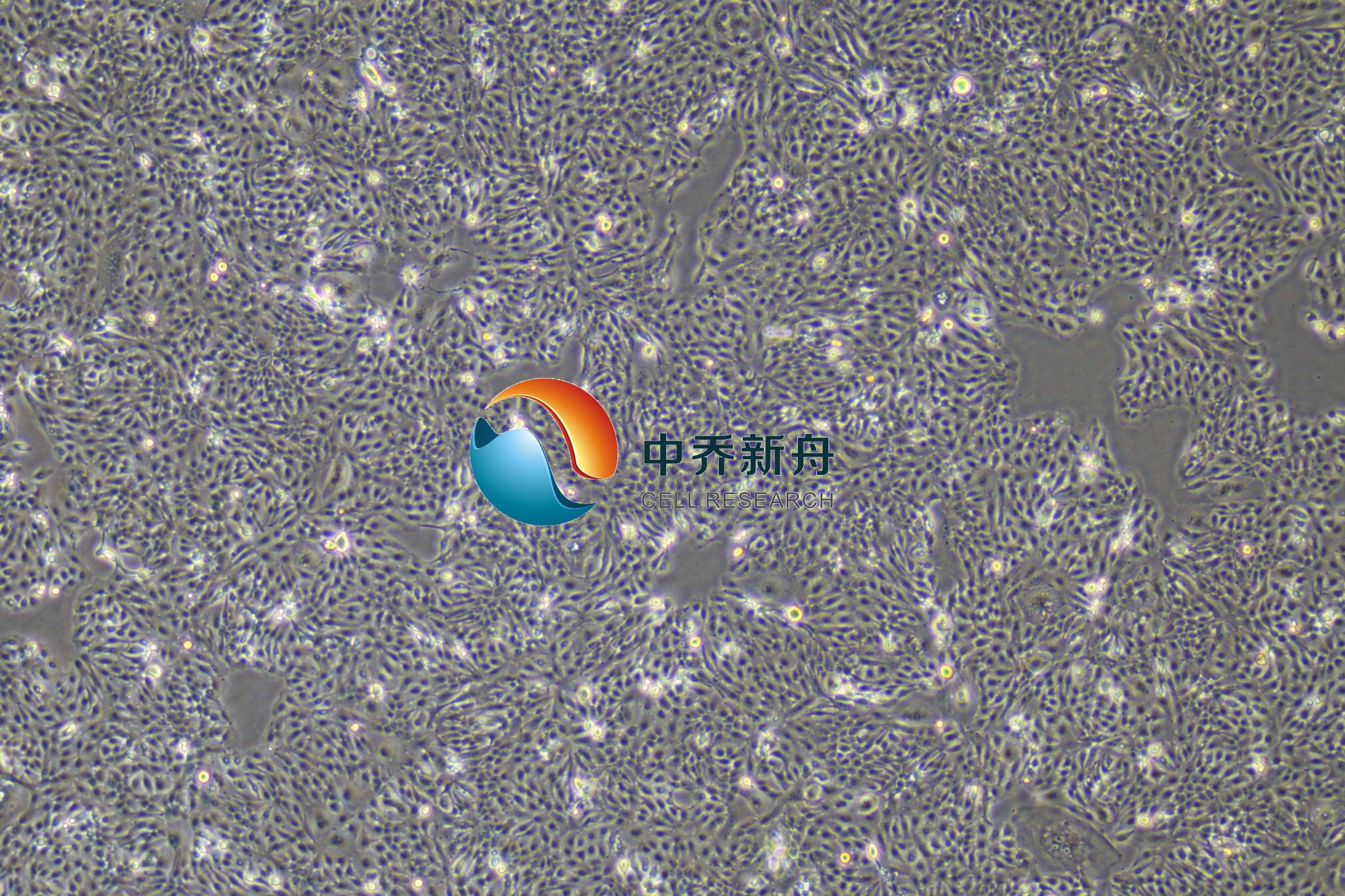 AMC-HN-8人喉癌细胞