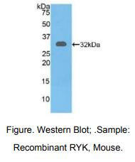 https://msimg.bioon.com/bionline/goods-no-pic.png