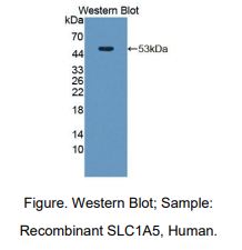 人溶质载体家族1成员5(SLC1A5)多克隆抗体