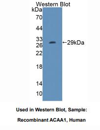 https://msimg.bioon.com/bionline/goods-no-pic.png