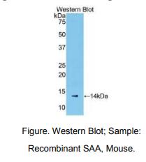 https://msimg.bioon.com/bionline/goods-no-pic.png