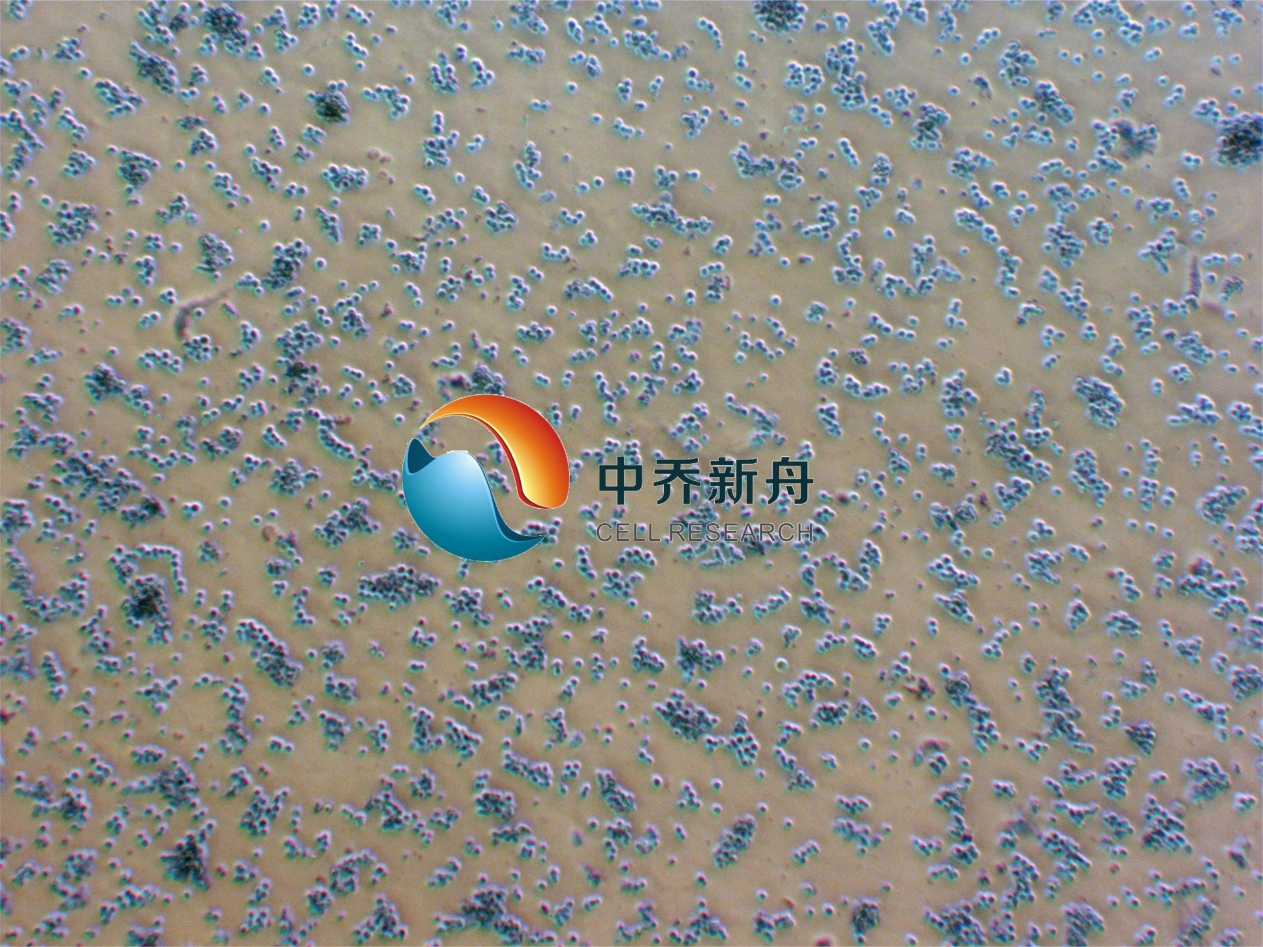 弥漫大B淋巴瘤细胞