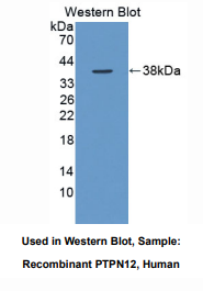 https://msimg.bioon.com/bionline/goods-no-pic.png