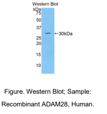 人解整合素金属蛋白酶28(ADAM28)多克隆抗体