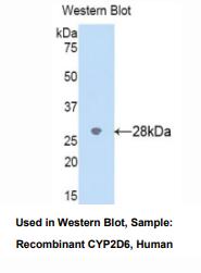 人细胞色素P450家族成员2D6(CYP2D6)多克隆抗体