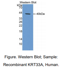 人角蛋白33A(KRT33A)多克隆抗体