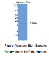 人肝细胞核因子1β(HNF1b)多克隆抗体