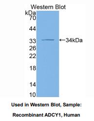 https://msimg.bioon.com/bionline/goods-no-pic.png