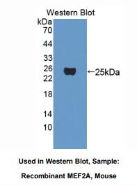 小鼠心肌细胞特异性增强因子2A(MEF2A)多克隆抗体