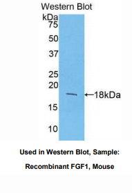 https://msimg.bioon.com/bionline/goods-no-pic.png