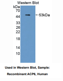 https://msimg.bioon.com/bionline/goods-no-pic.png