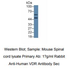 人维生素D受体(VDR)多克隆抗体